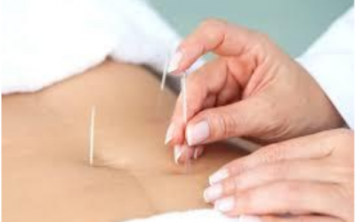 Acupuncture for Fertility