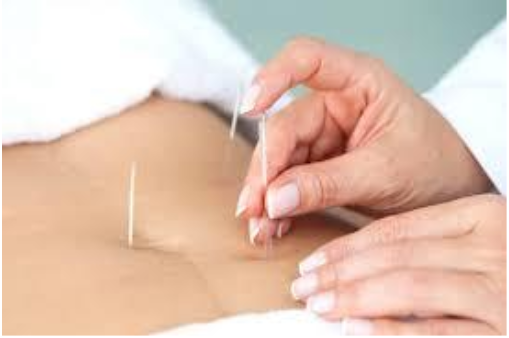 Acupuncture for Fertility